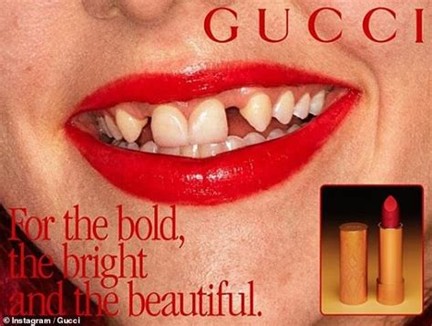 gucci lipstick ad missing teeth|Gucci bad teeth ad.